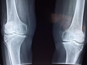 Home Orthopedie in Ede: diagnostische technieken en behandeling voor sterke botten en gewrichten
